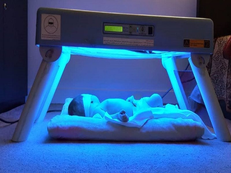 دستگاه زردی نوزادی